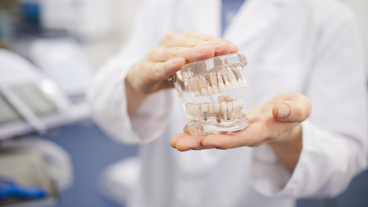 Implant Supported Dentures