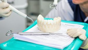 tmj bite guard covered by insurance